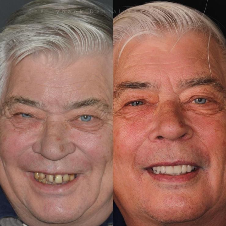 Transforming Smiles in Edinburgh 