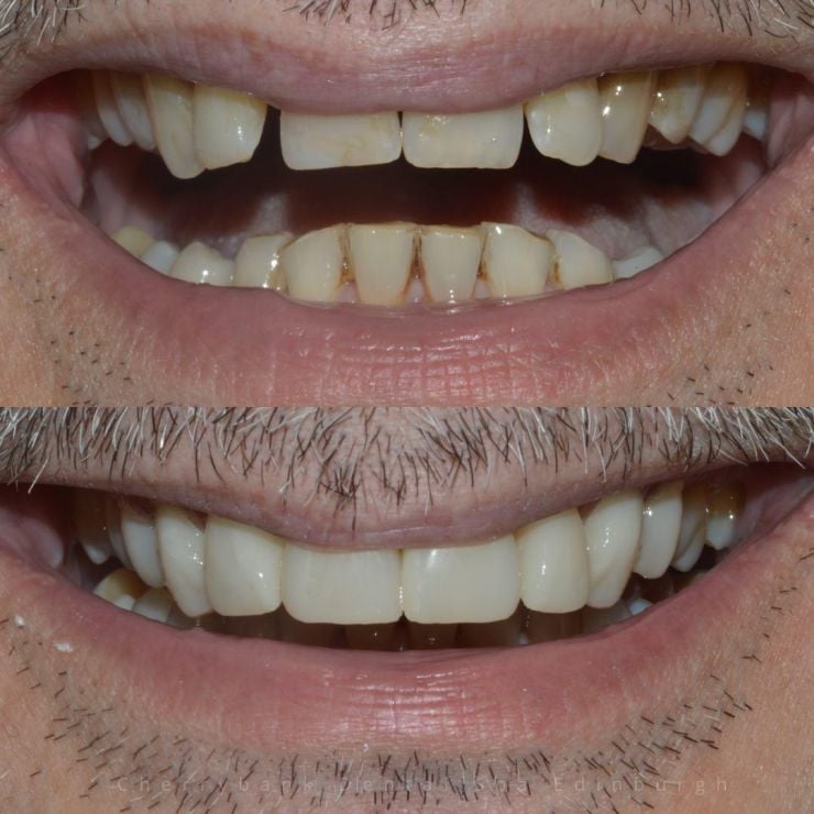 Transforming Smiles in Edinburgh 