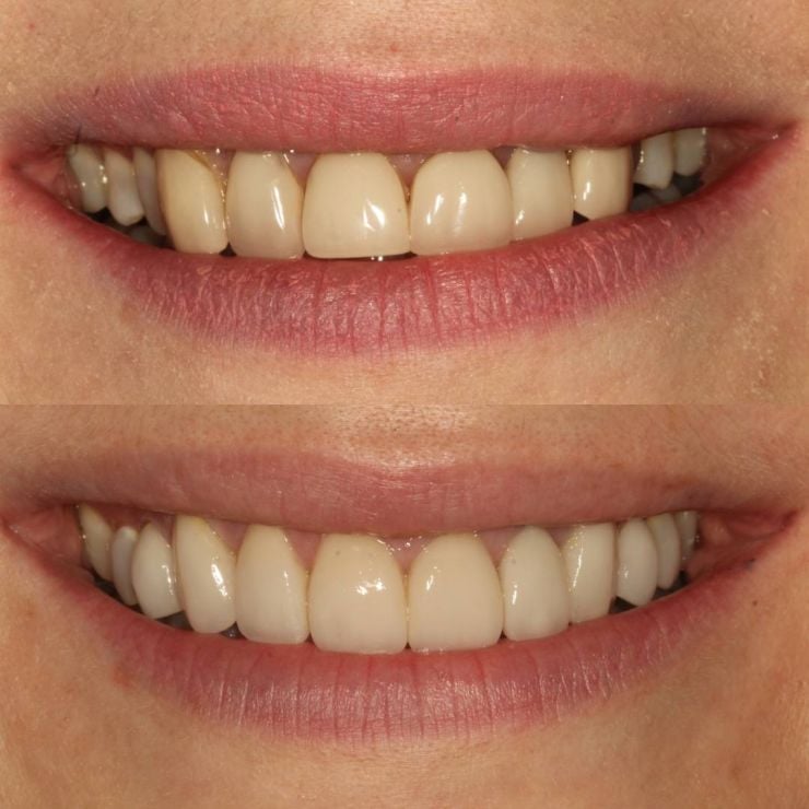 Transforming Smiles in Edinburgh 