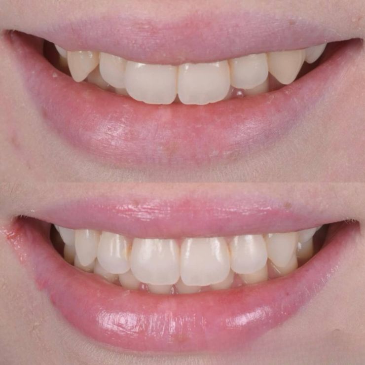 Transforming Smiles in Edinburgh 
