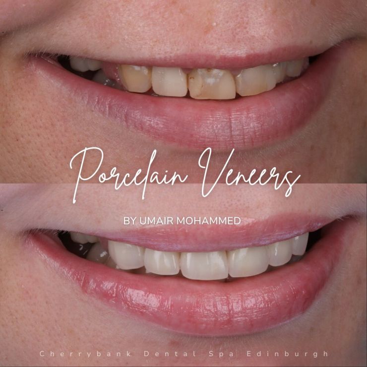 Smile Gallery | Cherrybank Dental Spa Edinburgh