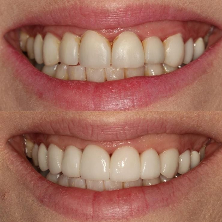 Transforming Smiles in Edinburgh 