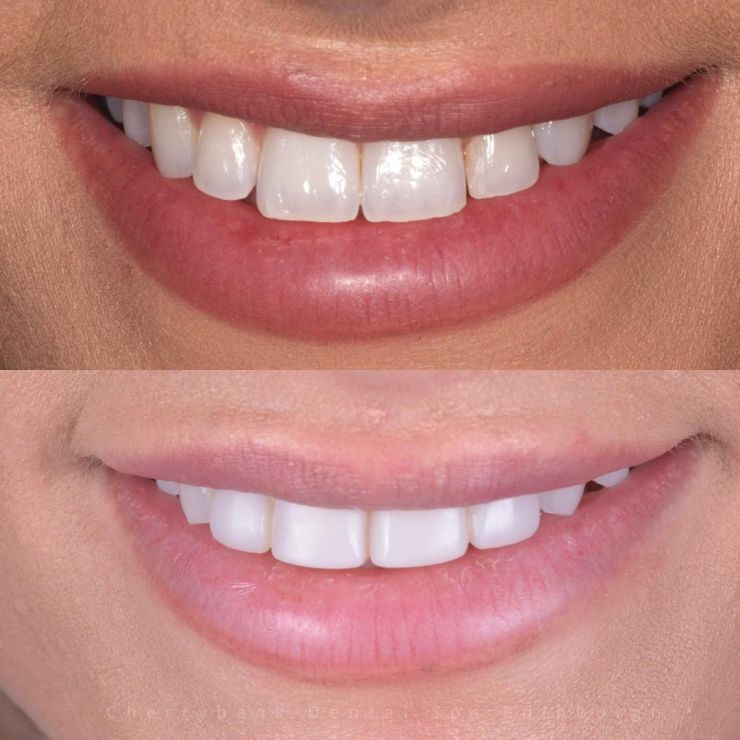 Transforming Smiles in Edinburgh 