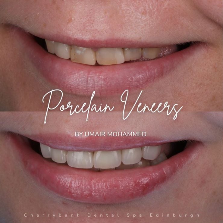 Smile Gallery | Cherrybank Dental Spa Edinburgh