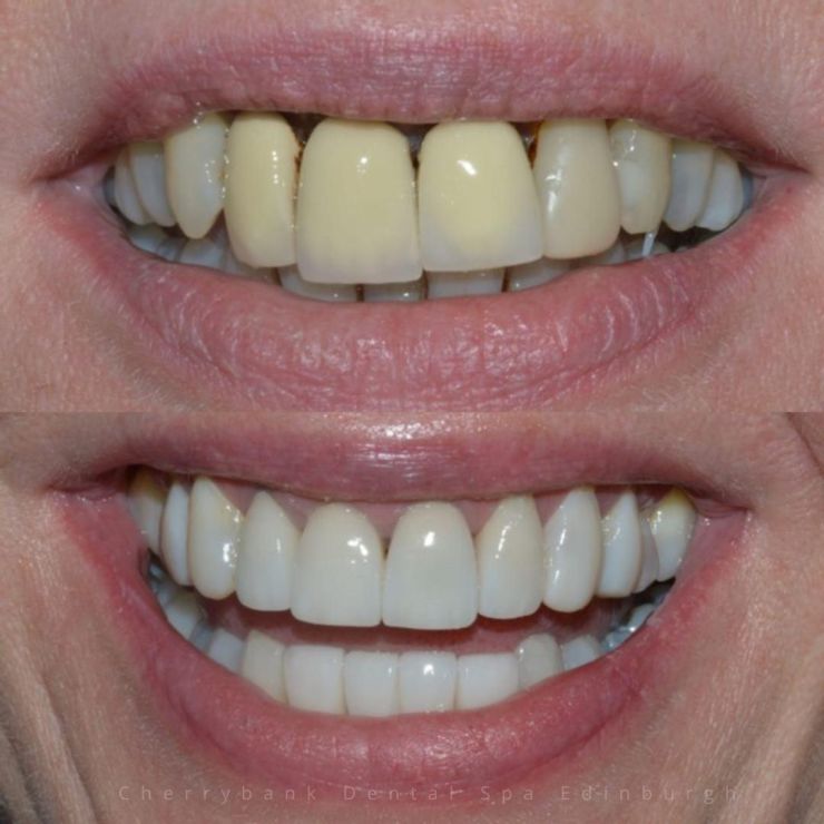 Transforming Smiles in Edinburgh 
